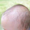 赤ちゃんの薄毛の原因と対策は？細くて薄い髪はいつまで続くのか