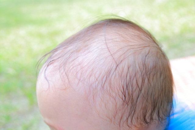 赤ちゃんの薄毛の原因と対策は 細くて薄い髪はいつまで続くのか